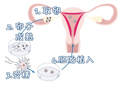 生殖医学科